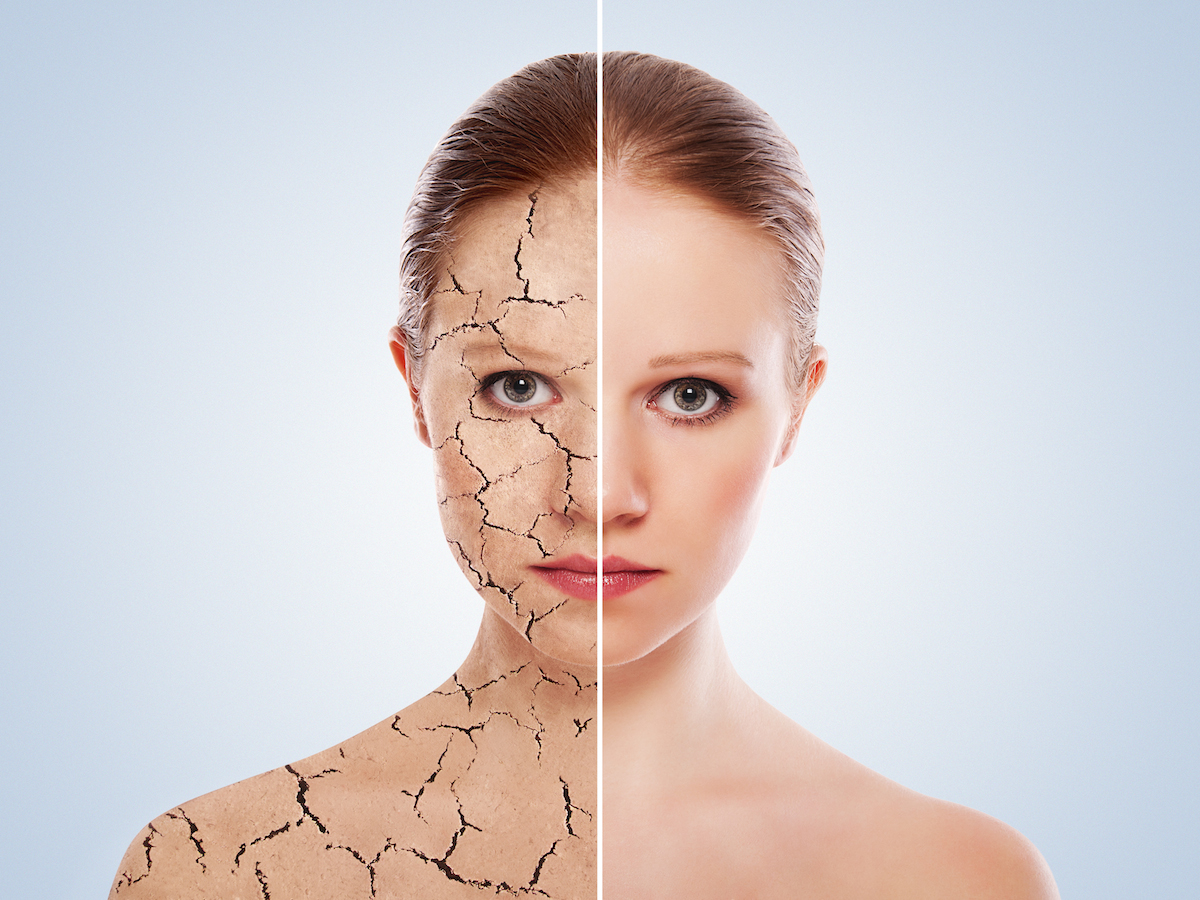 Concept of cosmetic effects, treatment and skin care. face of y