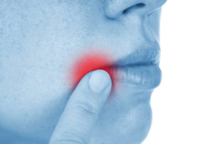 Рак губы на начальной стадии: характерные симптомы.