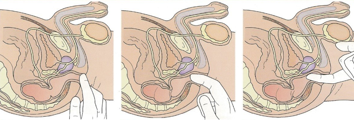 prostatita perna ortopedica new urine test for prostate cancer